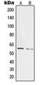 Pre-MRNA Processing Factor 19 antibody, orb215139, Biorbyt, Western Blot image 