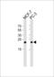 Proteasome 26S Subunit, Non-ATPase 10 antibody, 61-027, ProSci, Western Blot image 