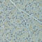 Serpin Family F Member 2 antibody, 23-991, ProSci, Immunohistochemistry paraffin image 