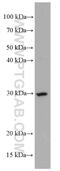 CD302 Molecule antibody, 66640-1-Ig, Proteintech Group, Western Blot image 