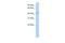 TraB Domain Containing antibody, A12798, Boster Biological Technology, Western Blot image 