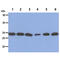Proteasome 26S Subunit, Non-ATPase 10 antibody, GTX57642, GeneTex, Western Blot image 