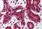 Tumor Protein P73 antibody, MBS241875, MyBioSource, Immunohistochemistry paraffin image 