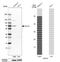 USH1 Protein Network Component Harmonin antibody, NBP1-89190, Novus Biologicals, Western Blot image 