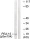 Proliferation And Apoptosis Adaptor Protein 15 antibody, 79-799, ProSci, Western Blot image 