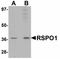 R-Spondin 1 antibody, LS-B4605, Lifespan Biosciences, Western Blot image 