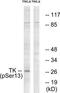 Thymidine Kinase 1 antibody, TA314628, Origene, Western Blot image 