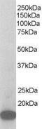 Actin Related Protein 2/3 Complex Subunit 3 antibody, NB300-895, Novus Biologicals, Western Blot image 