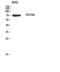 ADAM Metallopeptidase Domain 10 antibody, A00566, Boster Biological Technology, Western Blot image 