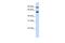 Alcohol Dehydrogenase Iron Containing 1 antibody, A09594, Boster Biological Technology, Western Blot image 