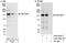 Zinc Finger MYND-Type Containing 8 antibody, A302-089A, Bethyl Labs, Immunoprecipitation image 