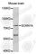 Sodium Channel Epithelial 1 Alpha Subunit antibody, A5538, ABclonal Technology, Western Blot image 