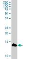 Lymphocyte antigen 6D antibody, H00008581-B02P, Novus Biologicals, Western Blot image 