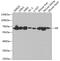 Apoptosis Inducing Factor Mitochondria Associated 1 antibody, GTX32428, GeneTex, Western Blot image 