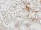 Hematopoietic Cell-Specific Lyn Substrate 1 antibody, NBP1-30953, Novus Biologicals, Immunohistochemistry paraffin image 