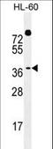 Double homeobox protein 4 antibody, LS-C167584, Lifespan Biosciences, Western Blot image 