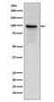 Thrombomodulin antibody, M01325-1, Boster Biological Technology, Western Blot image 