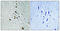 Splicing Factor 1 antibody, A01009S82, Boster Biological Technology, Immunohistochemistry paraffin image 