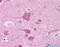 TOR antibody, ARP59155_P050, Aviva Systems Biology, Immunohistochemistry paraffin image 