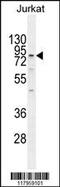 Engulfment and cell motility protein 2 antibody, 55-631, ProSci, Western Blot image 