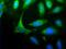 Homer Scaffold Protein 1 antibody, PA5-23023, Invitrogen Antibodies, Immunofluorescence image 