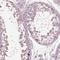 Opticin antibody, NBP2-55115, Novus Biologicals, Immunohistochemistry frozen image 
