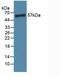 Angiopoietin 1 antibody, LS-C292803, Lifespan Biosciences, Western Blot image 