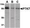 Tyrosine-protein kinase-like 7 antibody, PA5-20424, Invitrogen Antibodies, Western Blot image 