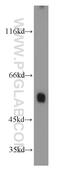 Autophagy Related 12 antibody, 11264-1-AP, Proteintech Group, Western Blot image 