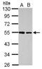 Dihydrouridine Synthase 2 antibody, NBP2-16233, Novus Biologicals, Western Blot image 