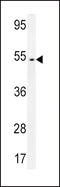 Terminal Nucleotidyltransferase 5A antibody, 55-162, ProSci, Western Blot image 