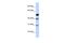 Transcription Factor AP-2 Beta antibody, A01858, Boster Biological Technology, Western Blot image 