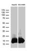 Interferon Induced Transmembrane Protein 2 antibody, M04964, Boster Biological Technology, Western Blot image 