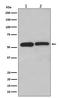 Lectin, Mannose Binding 1 antibody, M03628-1, Boster Biological Technology, Western Blot image 