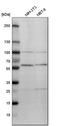 FKBP Prolyl Isomerase 4 antibody, HPA006148, Atlas Antibodies, Western Blot image 
