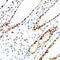 KH RNA Binding Domain Containing, Signal Transduction Associated 2 antibody, A09665, Boster Biological Technology, Immunohistochemistry frozen image 