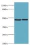 Suppressor Of Variegation 3-9 Homolog 2 antibody, LS-C379583, Lifespan Biosciences, Western Blot image 