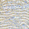Complement Component 4 Binding Protein Beta antibody, 22-158, ProSci, Immunohistochemistry frozen image 