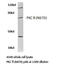 Protein Kinase C Theta antibody, AP20760PU-N, Origene, Western Blot image 