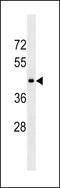 5-Hydroxytryptamine Receptor 1D antibody, 60-354, ProSci, Western Blot image 