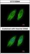 Golgi Brefeldin A Resistant Guanine Nucleotide Exchange Factor 1 antibody, GTX102644, GeneTex, Immunocytochemistry image 