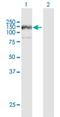 Ankyrin Repeat And FYVE Domain Containing 1 antibody, H00051479-B01P, Novus Biologicals, Western Blot image 