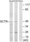 Secretin Receptor antibody, LS-C120949, Lifespan Biosciences, Western Blot image 