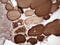 Thyroglobulin antibody, LS-C339049, Lifespan Biosciences, Immunohistochemistry paraffin image 