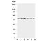 Presenilin 2 antibody, R30425, NSJ Bioreagents, Western Blot image 