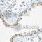 Insulin Like Growth Factor 2 MRNA Binding Protein 3 antibody, A4444, ABclonal Technology, Immunohistochemistry paraffin image 