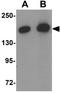 Rho GTPase Activating Protein 39 antibody, GTX16240, GeneTex, Western Blot image 