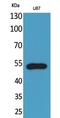 C-X3-C Motif Chemokine Receptor 1 antibody, A00280-1, Boster Biological Technology, Western Blot image 