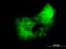 Protein Kinase C Delta antibody, H00005580-M06, Novus Biologicals, Immunocytochemistry image 