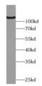 C2 Calcium Dependent Domain Containing 5 antibody, FNab04535, FineTest, Western Blot image 